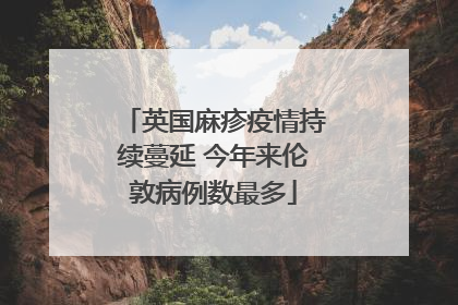 英国麻疹疫情持续蔓延 今年来伦敦病例数最多